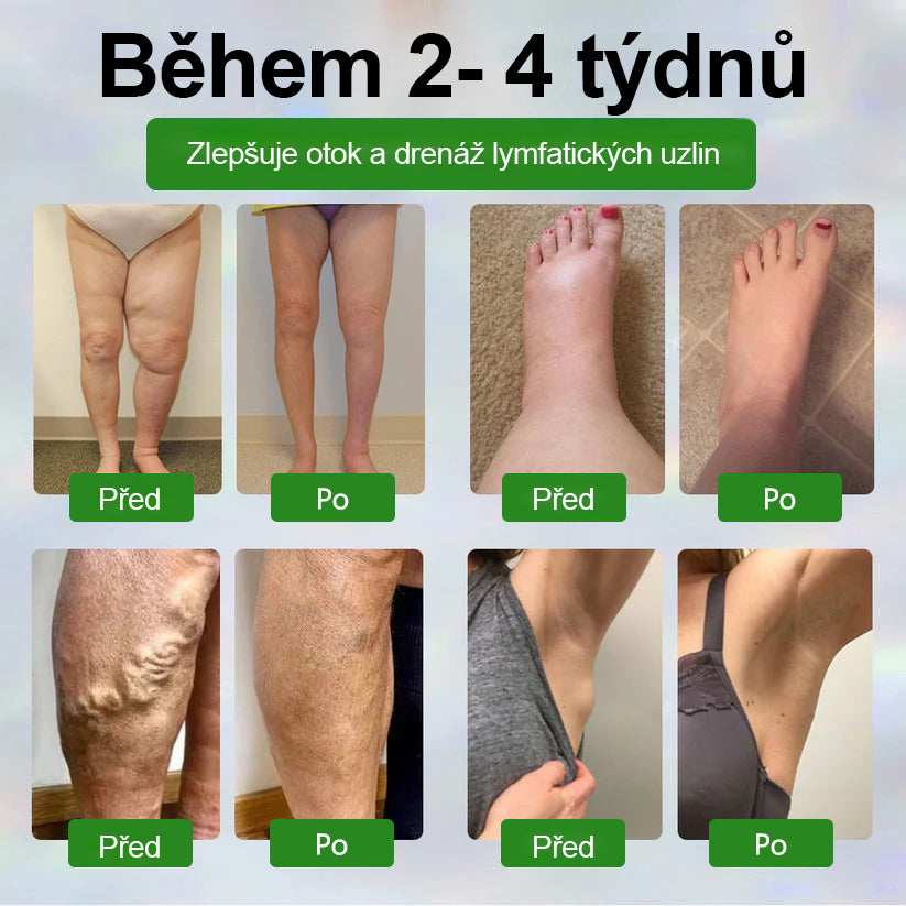 🌿🌿Malenia® Bylinný krém zmírňující otoky s černuchou