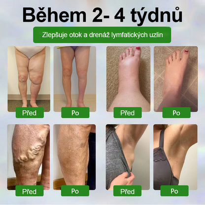 🌿🌿Malenia® Bylinný krém zmírňující otoky s černuchou