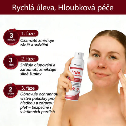 🔥Malenia® Snail Repair Spray pro svědivou, šupinatou pokožku s psoriázou