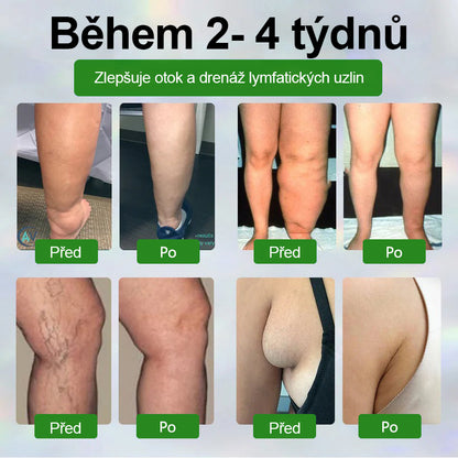 🌿🌿Malenia® Bylinný krém zmírňující otoky s černuchou