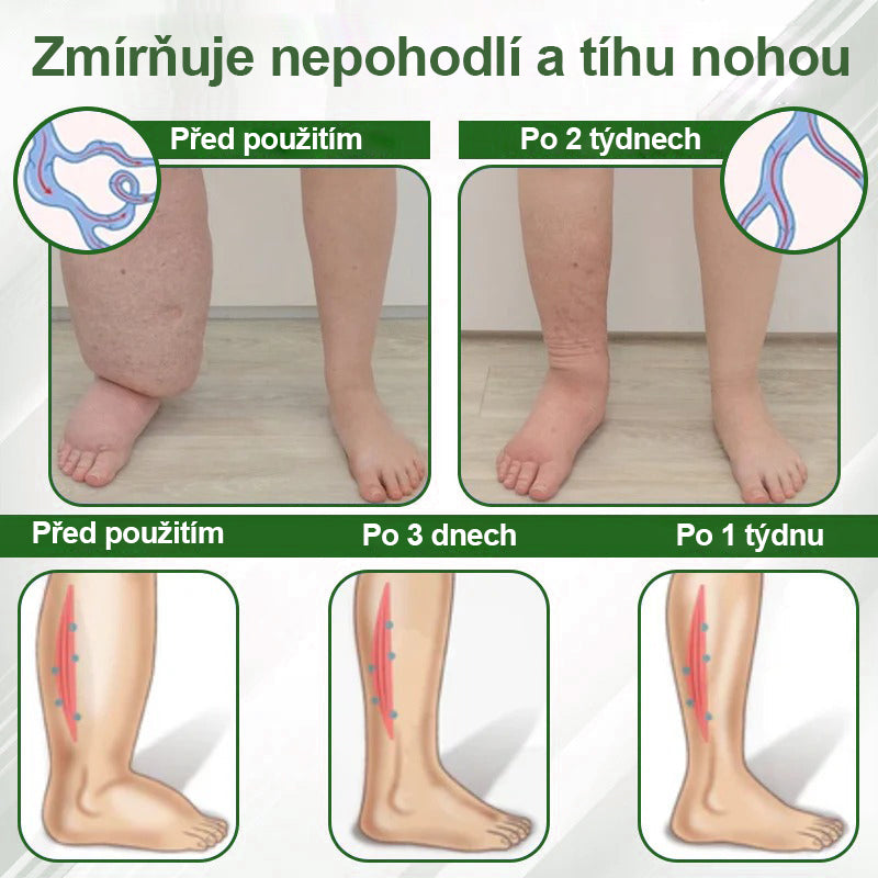 🌿🌿Malenia® Bylinný krém zmírňující otoky s černuchou