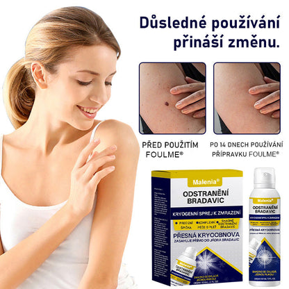 🔥Malenia® WartErase Kryogenní sprej