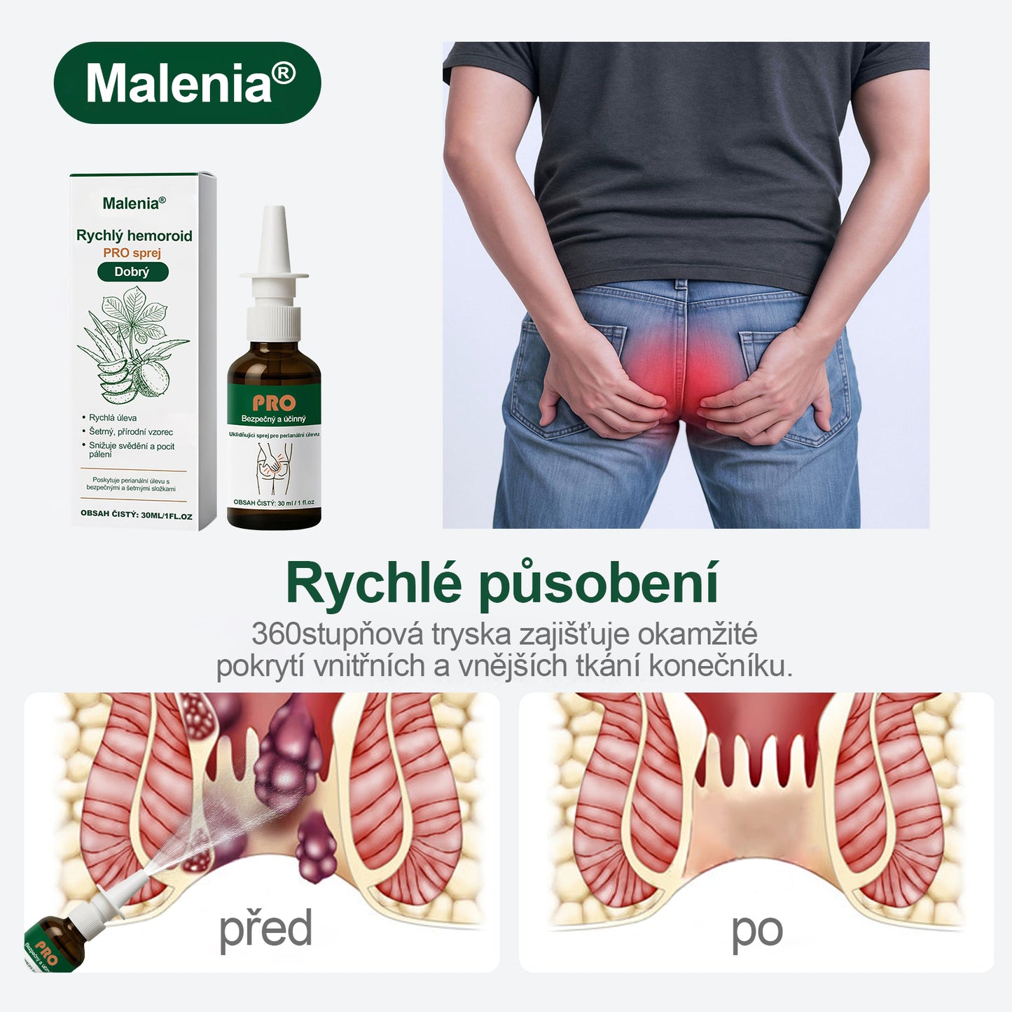 🎁Malenia® Rychlý sprej proti hemoroidům PRO