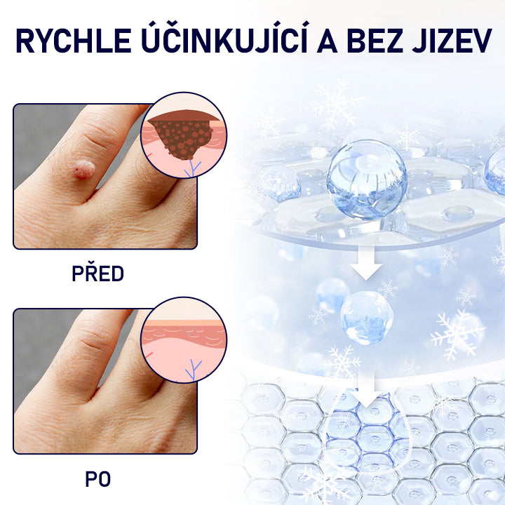 🔥Malenia® WartErase Kryogenní sprej