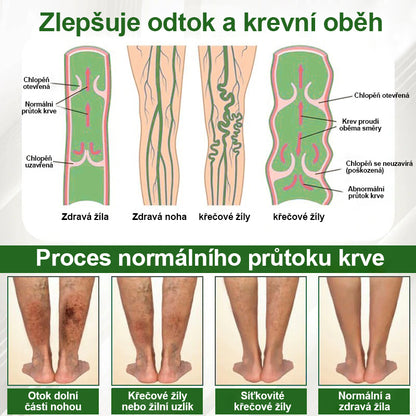 🌿🌿Malenia® Bylinný krém zmírňující otoky s černuchou