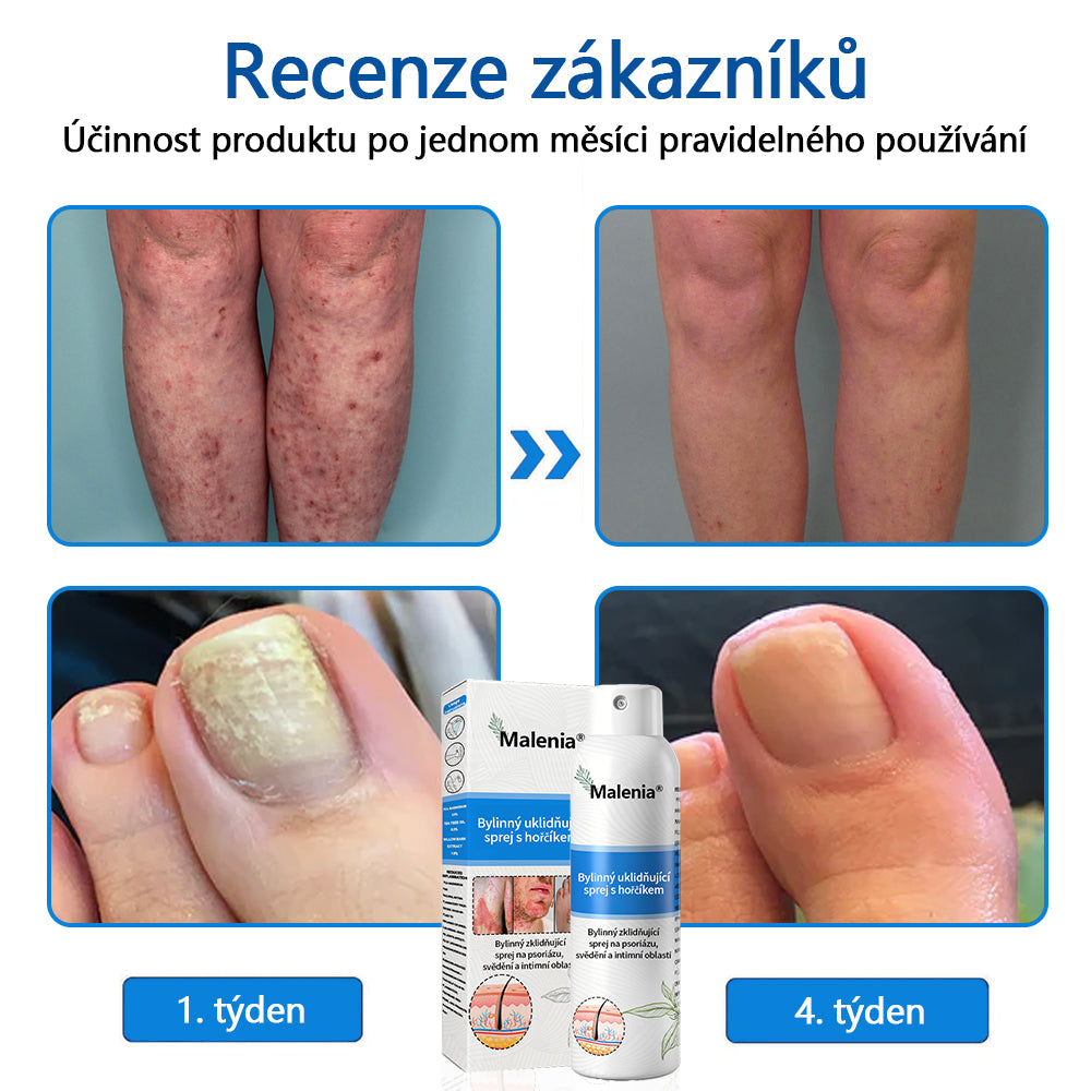 【Oficiální značkový obchod】✅Malenia® Magnesium bylinný sprej