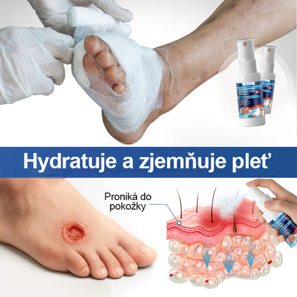 Malenia® GlucoDerm bariérový sprej✨✨✨