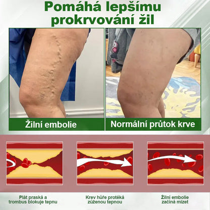 🌿🌿Malenia® Bylinný krém zmírňující otoky s černuchou