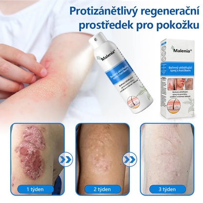 【Oficiální značkový obchod】✅Malenia® Magnesium bylinný sprej