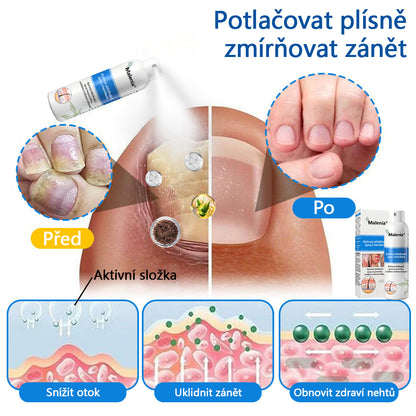 【Oficiální značkový obchod】✅Malenia® Magnesium bylinný sprej